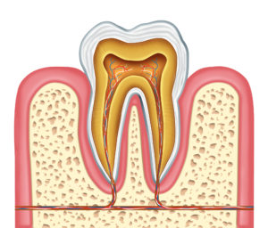 Root canal