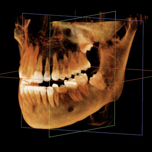 Dental imaging columbia sc