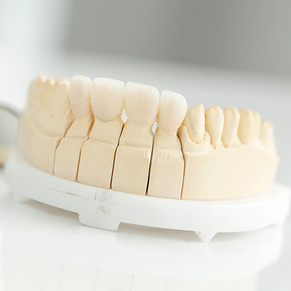 Dental crown square