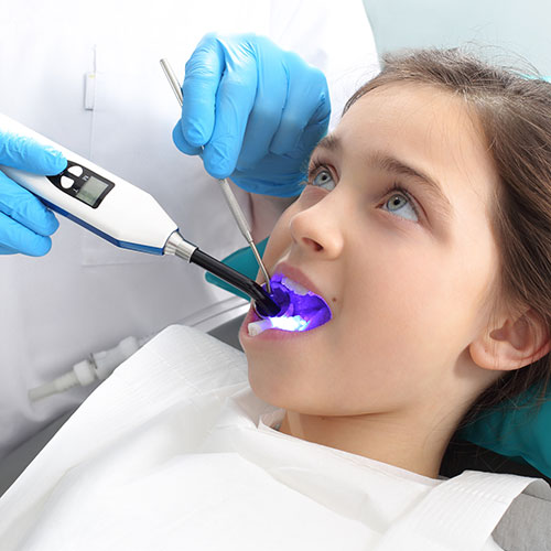 Fluoride varnish and tooth sealant